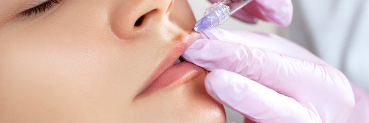 Dermal fillers for lips