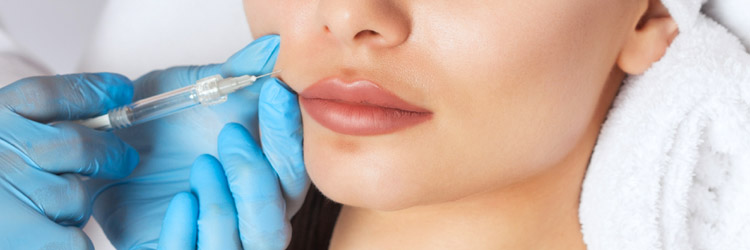 Marionette fillers to add volume to your cheeks
