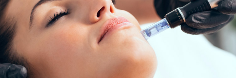 Microneedling Facial Treatments