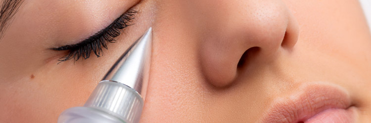Plasma Pen / Fibroblast Facial Treatment in Retford